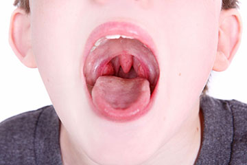 Nose and Sinus Disorders